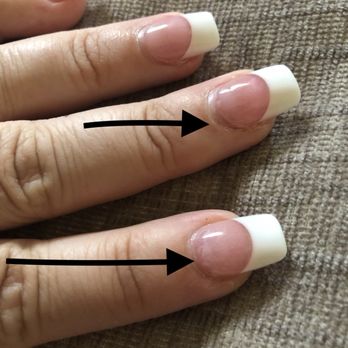 Copper Nails & Spa - Lifting after a week and 2 days - Nail Salons Near Me - Fresno, California Copper Nails & Spa - Lifting after a week and 2 days - Nail Salons Near Me - Fresno, California
