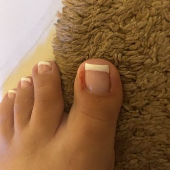 Elite Nails And Spa - The cut got worse today I got this pedicure yesterday. - Nail Salons Near Me - Simi Valley, California