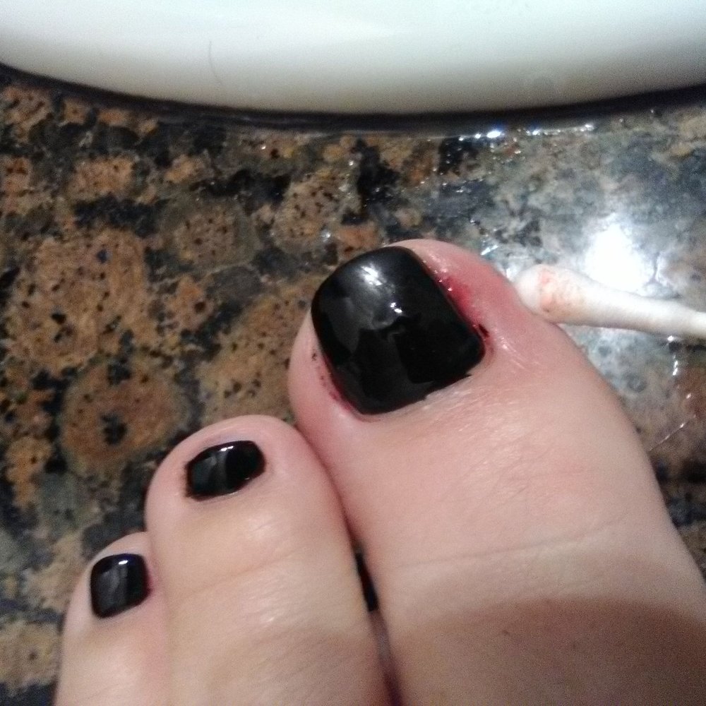 Infection less than 24 hours of having my pedicure done and being cut by the technician. Infection less than 24 hours of having my pedicure done and being cut by the technician.