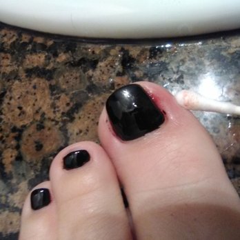 Nail Trendz - Infection less than 24 hours of having my pedicure done and being cut by the technician. - Nail Salons Near Me - Palmdale, California