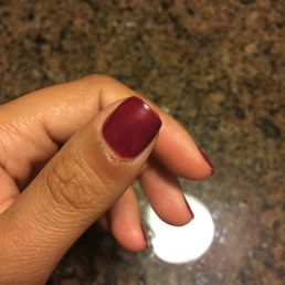 Where my cuticle was clipped.