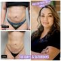 Photo of Beautiful Body Sculpting