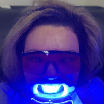 Smile Again Teeth Whitening - Teeth Whitening Near Me - Honolulu, Hawaii Smile Again Teeth Whitening - Teeth Whitening Near Me - Honolulu, Hawaii