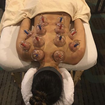 Adpt - Cupping therapy can help with releasing fascial and muscle tension along with bringing more blood to areas to promote healing. - Massage Therapy Near Me - Belmont, California Adpt - Cupping therapy can help with releasing fascial and muscle tension along with bringing more blood to areas to promote healing. - Massage Therapy Near Me - Belmont, California