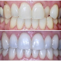 Carlson Dentistry