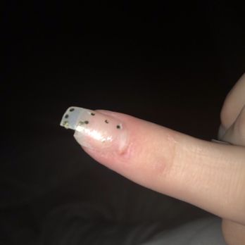 Perfect Nails - DAY 11 Yes, we changed the polish a few days ago, filed down blobs and bumps. Nails are breaking off. - Nail Salons Near Me - Medford, Oregon Perfect Nails - DAY 11 Yes, we changed the polish a few days ago, filed down blobs and bumps. Nails are breaking off. - Nail Salons Near Me - Medford, Oregon