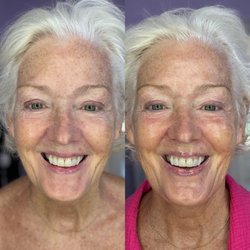 The Skin Whisperer - Immediate results with just one session! I have the most gorgeous clients.
