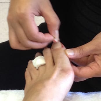 Dublin Nails - The 3rd time she cleaning wound area - Nail Salons Near Me - Dublin, California Dublin Nails - The 3rd time she cleaning wound area - Nail Salons Near Me - Dublin, California