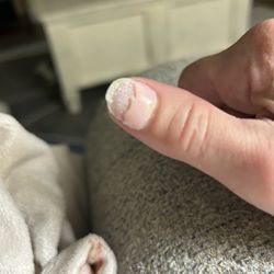 City Nails & Spa - Nails should not look like this after less than a week!