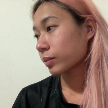 Anthony J Badame, MD - This is the side of my nose post-op two years! - Dermatologists Near Me - San Jose, California Anthony J Badame, MD - This is the side of my nose post-op two years! - Dermatologists Near Me - San Jose, California