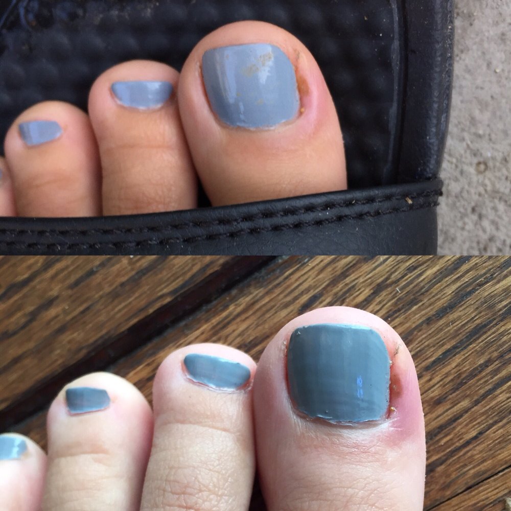 A few days ago, and today. It's only getting worse.. A few days ago, and today. It's only getting worse..