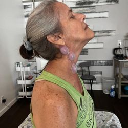 Loosen Up - cupping