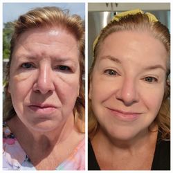 Korean Skin Care