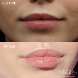 Imagen Body Sculpting & Cosmetic Center