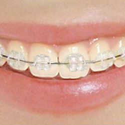 Susquehanna Orthodontics