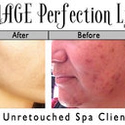 Lana's Skin Rejuvenation