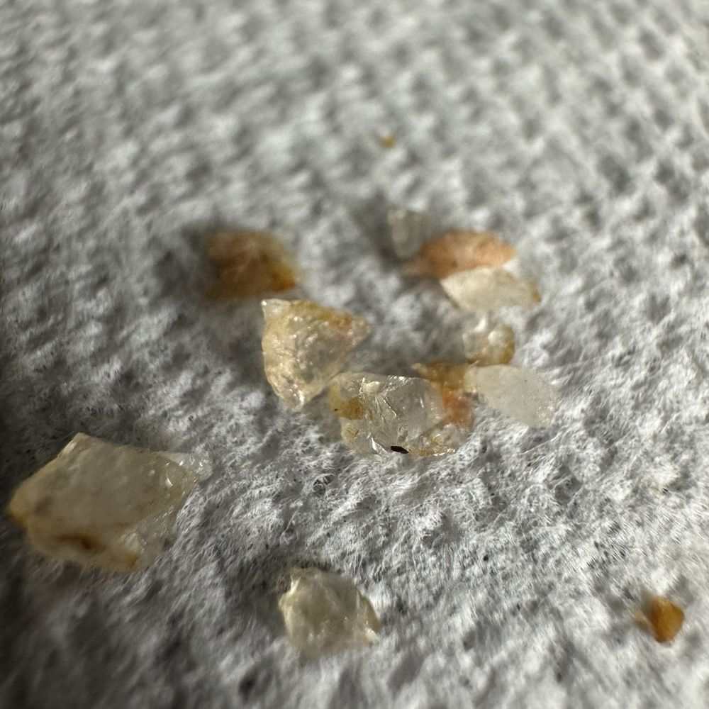ThaiLand To Go - The drunken noodles had chunks of glass which broke my tooth. - Thai Near Me - Temecula, California