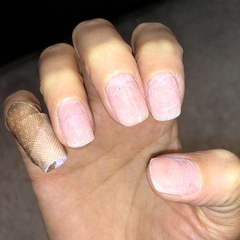Cordova Nails - Let's hope I don't get an infection - Nail Salons Near Me - Rancho Cordova, California Cordova Nails - Let's hope I don't get an infection - Nail Salons Near Me - Rancho Cordova, California
