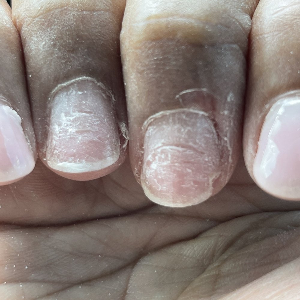 Passion Nails & Spa - Damaged Nails - Nail Salons Near Me - Flowery Branch, Georgia Passion Nails & Spa - Damaged Nails - Nail Salons Near Me - Flowery Branch, Georgia