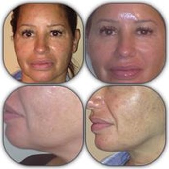 Facial Expressions - Skin Care Near Me - Hollywood, Florida Facial Expressions - Skin Care Near Me - Hollywood, Florida