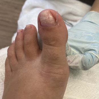 Utopia Beauty Salon - This is what my nail took out, I should not have that much since I had just gone 2 weeks prior. - Nail Salons Near Me - Arcadia, California
