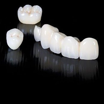 Kristin Soraya, DDS - Dental Crown: Starting at $950 - Pediatric Dentists Near Me - Laguna Hills, California Kristin Soraya, DDS - Dental Crown: Starting at $950 - Pediatric Dentists Near Me - Laguna Hills, California
