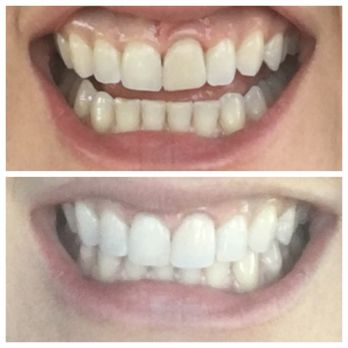 Arcadia Dental Arts - General Dentistry Near Me - Phoenix, Arizona Arcadia Dental Arts - General Dentistry Near Me - Phoenix, Arizona