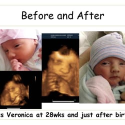Stork Vision