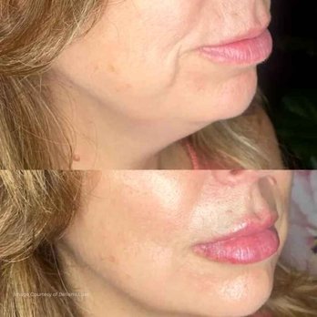 Plasmagique - Skin Care Near Me - Sausalito, California