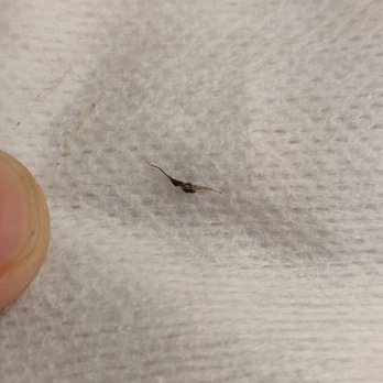 Wascow Dental - Dead tooth nerve, after Dr.Doreen Wascow did tooth filling. - General Dentistry Near Me - Mundelein, Illinois Wascow Dental - Dead tooth nerve, after Dr.Doreen Wascow did tooth filling. - General Dentistry Near Me - Mundelein, Illinois