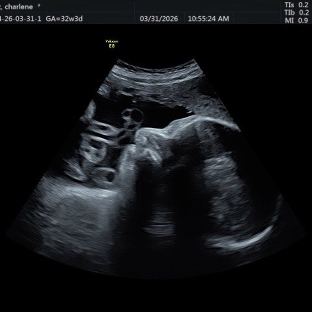 Baby’s First Glance - Ultrasound Imaging Centers Near Me - San Jose, California Baby’s First Glance - Ultrasound Imaging Centers Near Me - San Jose, California
