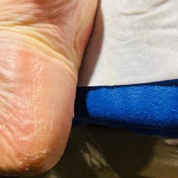 Utopia Nails II - Bad pedicure. The photo was taken while I was still in the salon chair getting dressed.... - Nail Salons Near Me - Kenosha, Wisconsin