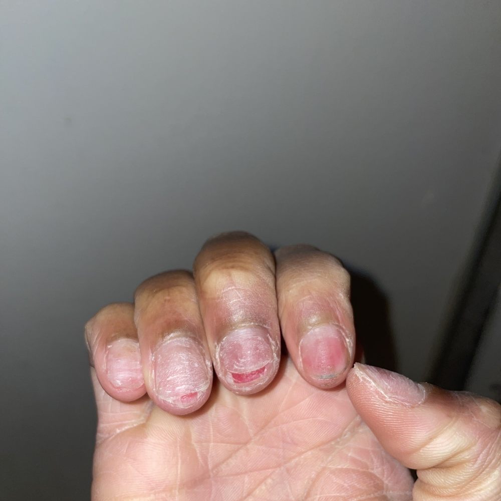 NY Tony's Nails - SAVE YOUR MONEY & YOUR NAILS!!!!!! - Nail Salons Near Me - The Bronx, New York NY Tony's Nails - SAVE YOUR MONEY & YOUR NAILS!!!!!! - Nail Salons Near Me - The Bronx, New York