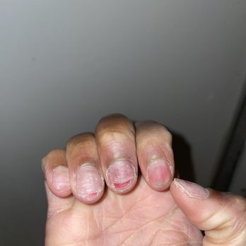 NY Tony's Nails - SAVE YOUR MONEY & YOUR NAILS!!!!!! - Nail Salons Near Me - The Bronx, New York NY Tony's Nails - SAVE YOUR MONEY & YOUR NAILS!!!!!! - Nail Salons Near Me - The Bronx, New York