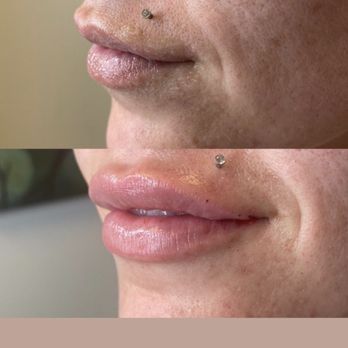 Advanced Aesthetics - Medical Spas Near Me - Las Vegas, Nevada Advanced Aesthetics - Medical Spas Near Me - Las Vegas, Nevada