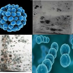 Black Mold Analysis - Black Mold Analysis 321-443-7315