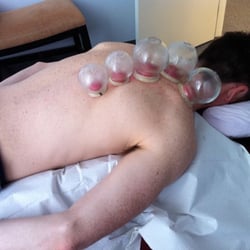 Cleveland Acupuncture