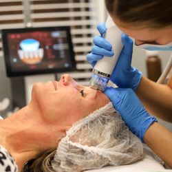 Skin & Sculpt Medical Spa - RENEW & REVITALIZE Secret RF is the perfect way to achieve skin revitalization.