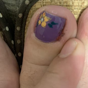 Rabbit Nails & Spa - This is the first time when I had the ingrown toenail. I've had it done before and it never looked like this after. - Nail Salons Near Me - Bradenton, Florida Rabbit Nails & Spa - This is the first time when I had the ingrown toenail. I've had it done before and it never looked like this after. - Nail Salons Near Me - Bradenton, Florida