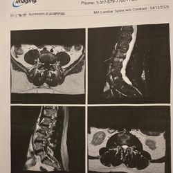 Daniel L Kim, MD - Indiana Spine Group
