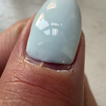 Nail Monster - 6 days later, inflamed finger - Nail Salons Near Me - Brookline, Massachusetts