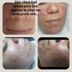 Jézett Skin Care