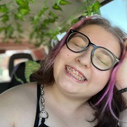 Chenin Orthodontic Group- Henderson - Before getting braces off
