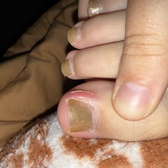 Nirvana Beauty Lounge - Infected toe. - Nail Salons Near Me - Reno, Nevada