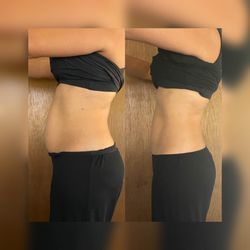 Glam lab - Body Contouring Cavitation & RF
