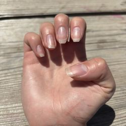 Gel fell off
