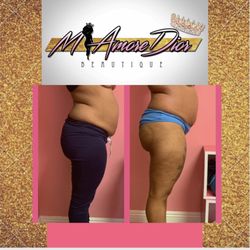 Miamoredior Body Beautique - Queen Body Package BBL, Lipo Cavitation, Laser Lipo and RF Body