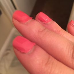 Peeling off after 2 days