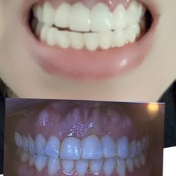 Glenn Y Arima, DDS - Thank you for bringing back my smile!