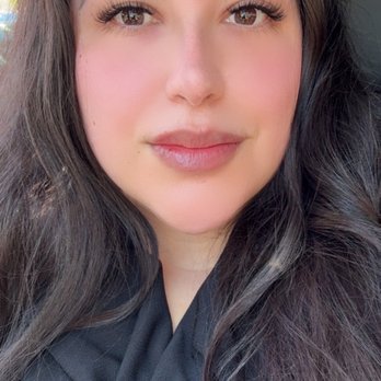 Tailored Peninsula Injectables - Immediately after Botox and lip filler - Medical Spas Near Me - Menlo Park, California